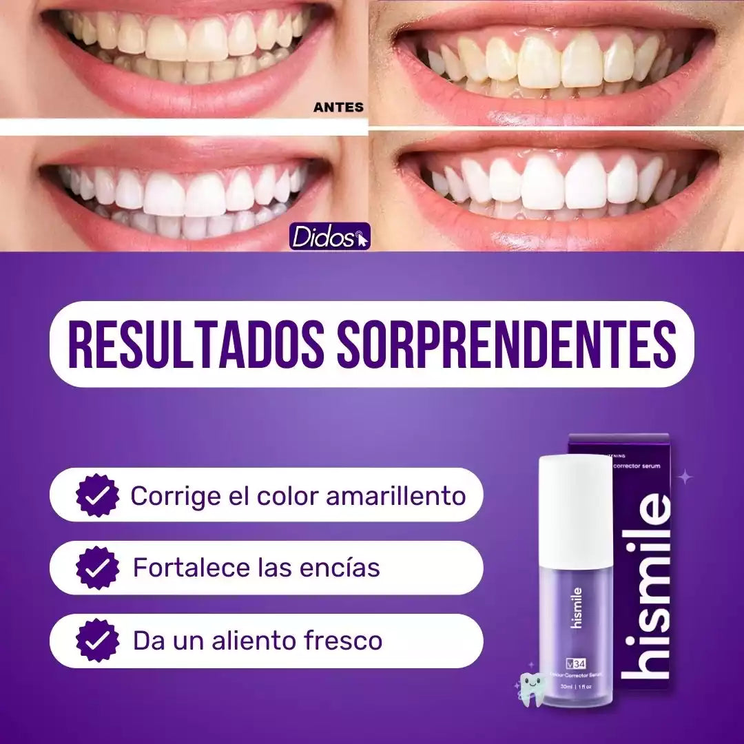 CREMA DENTAL BLANQUEADORA PERFECT SMILE ™